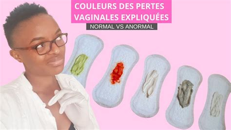 mycose vaginale perte|Mycose vaginale : le guide complet